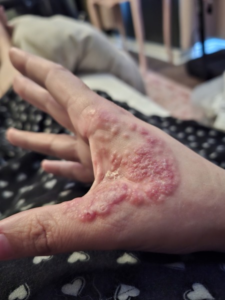 How long till antibiotics kick in?