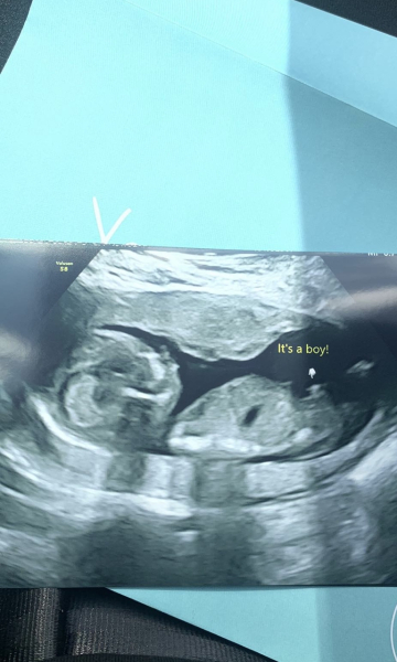 Due February 2025 - Thread 3