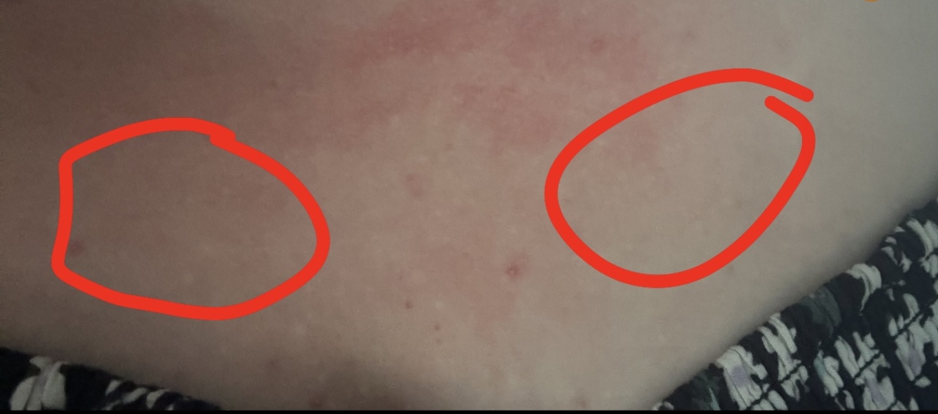 What is here in the body?