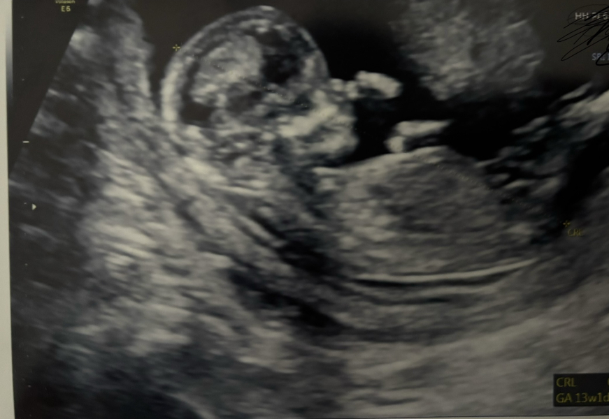 Due March 2025 thread 2