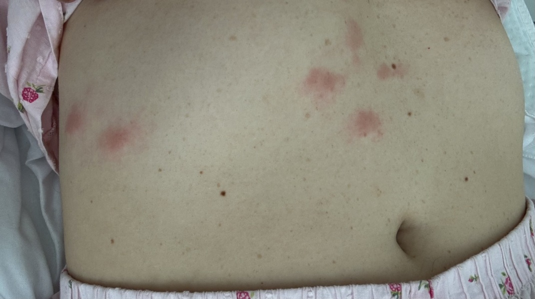 What’s bitten me? (Pic)
