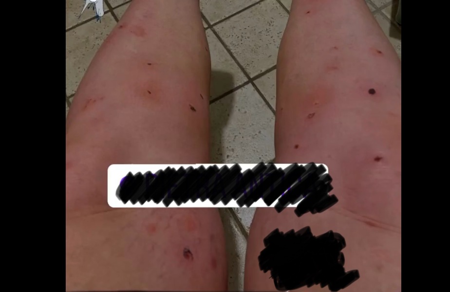 Desperately need recommendations for mosquito deterrent please!