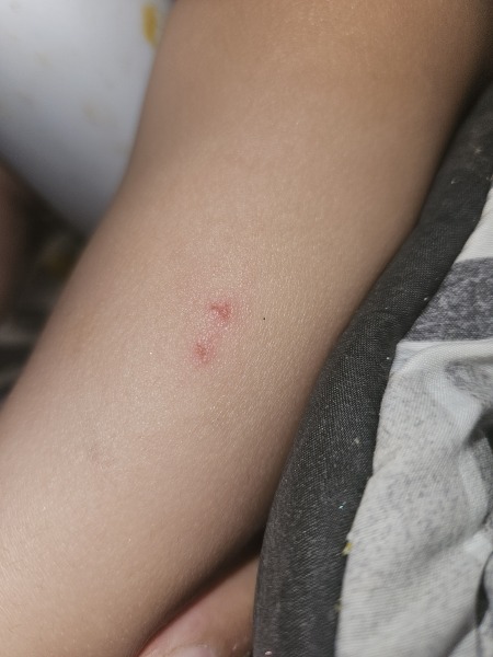Spider bite? What are these marks?