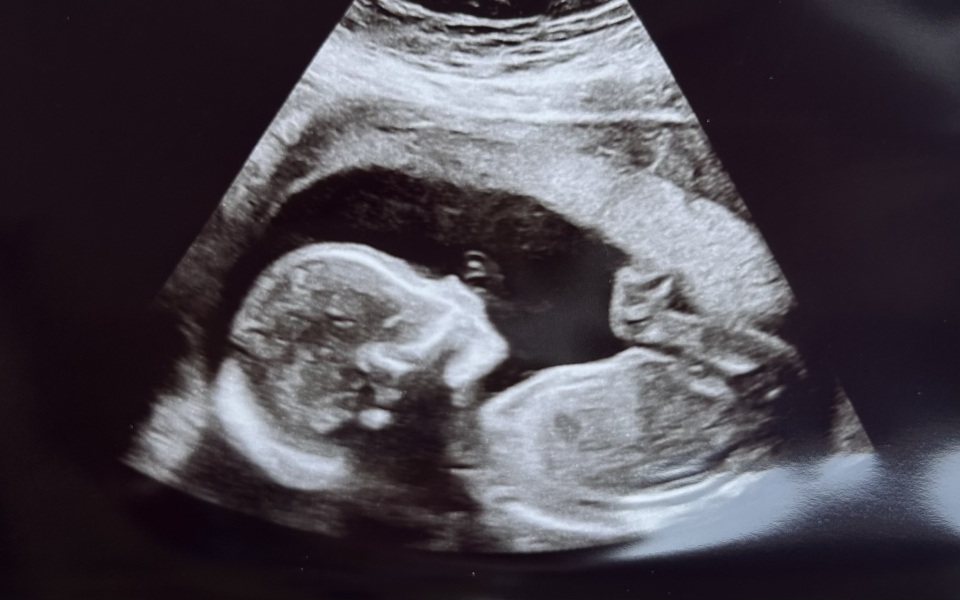 Pregnant and on 2ww pathway as I’ve found a lump
