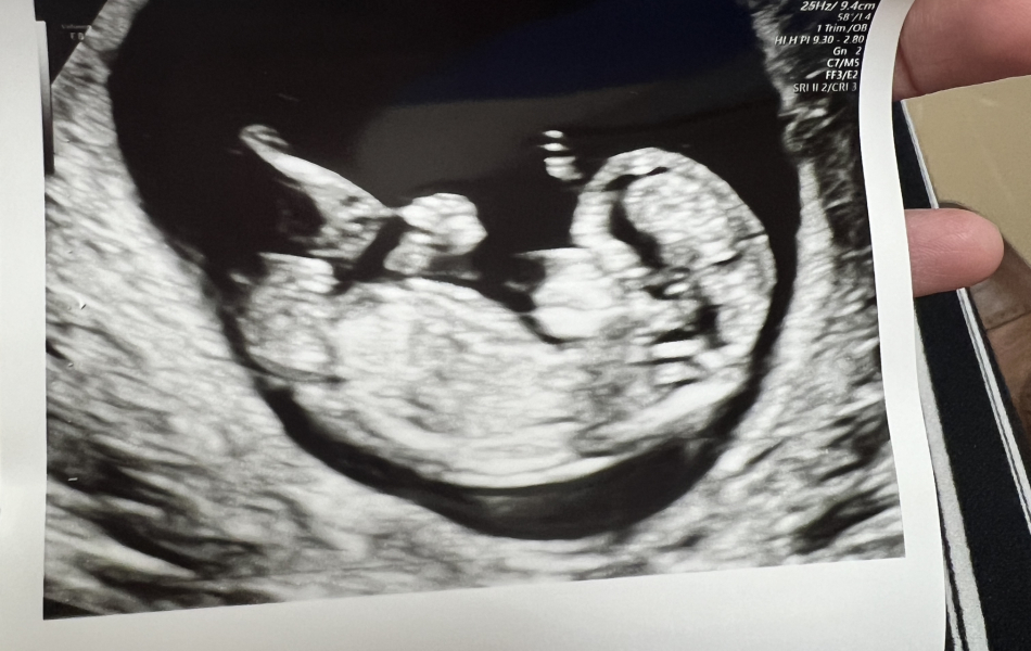 BFP after IVF - the journey continues (part 2)