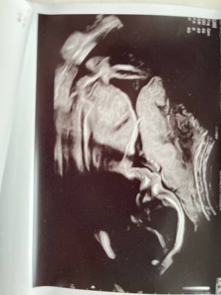 Do you want me to guess the sex? 12 week scans.