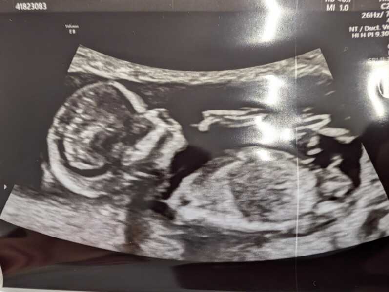 Due February 2025 - Thread 3