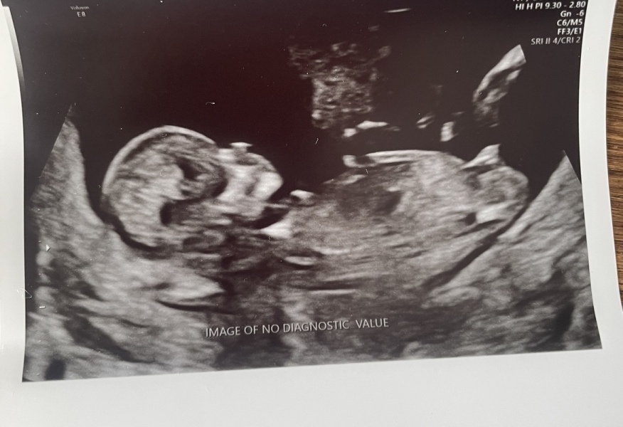 Gender guesses based on nub?