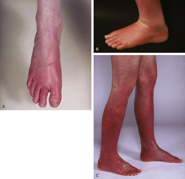 What on earth is wrong with my legs? (Pics)