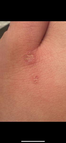 To be worried about this on my foot?