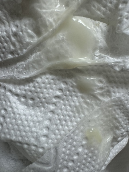 8DPO discharge query - any thoughts appreciated!!