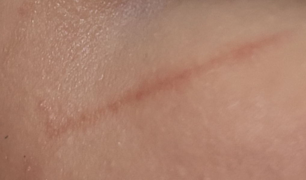 First time dad - Scratch on face how is best to heal?