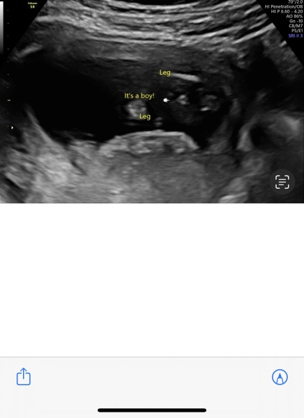 Gender scan