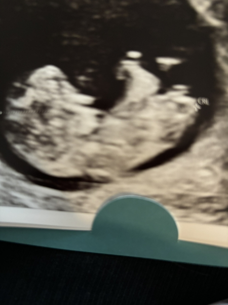 Due March 2025 thread 2