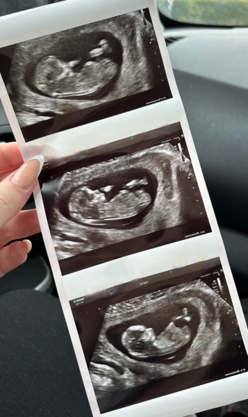 No fetal pole