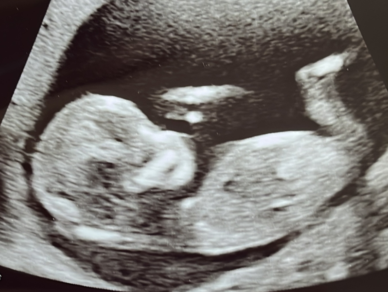 Due February 2025 - Thread 3