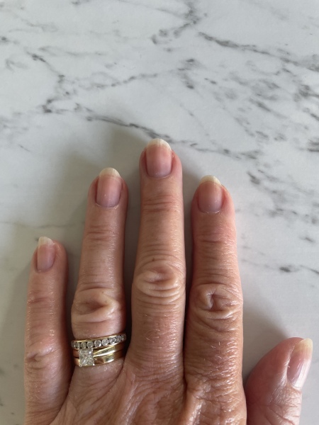Please can anyone advise on my nails