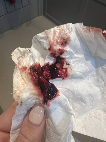Advice please -Miscarrying? *graphic warning*