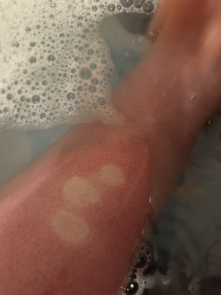 What on earth is wrong with my legs? (Pics)