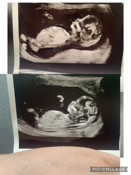 Due February 2025 - Thread 3