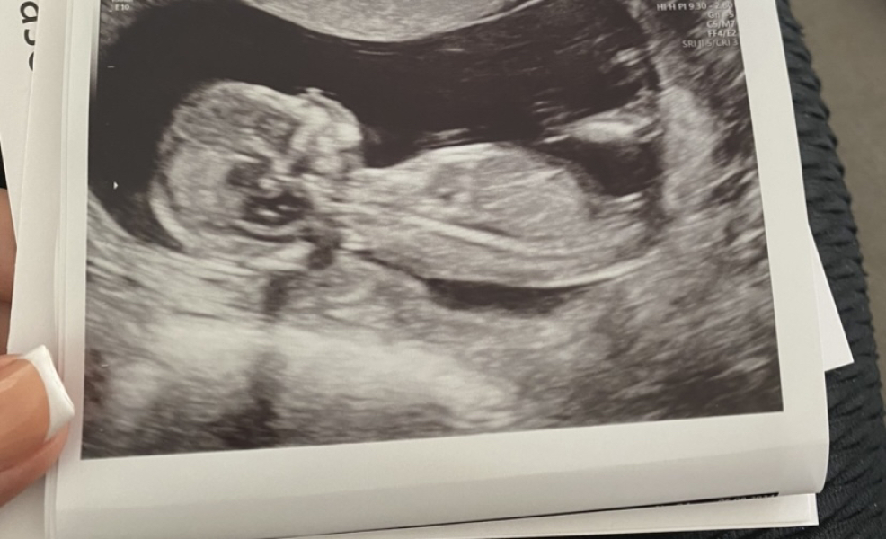 Due February 2025 - Thread 3