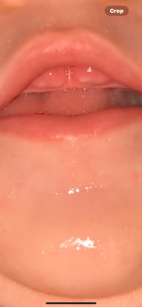 How long would you reckon for teeth to be out?