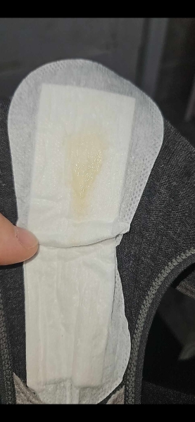 Help! Yellow discharge looking.
