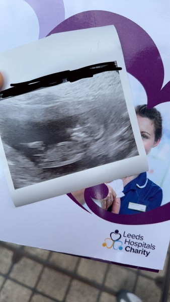 Boy or girl?!