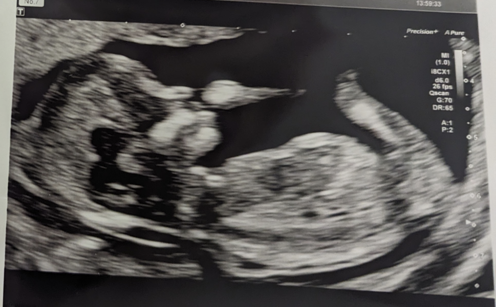 Any gender guesses please?