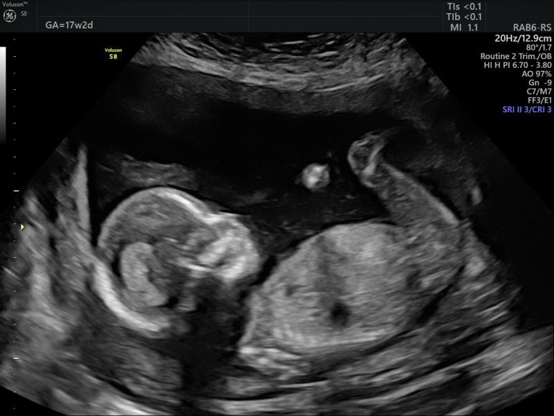 Due February 2025 - Thread 3