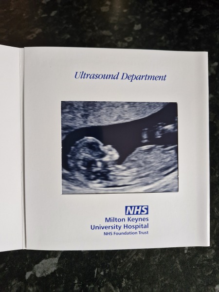 BFP after IVF - the journey continues (part 2)