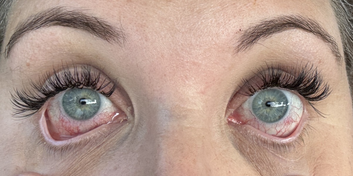 Sore lash extensions with pics
