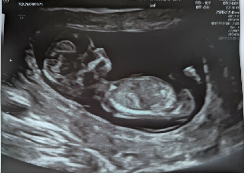 12 week sonographer said 'she'