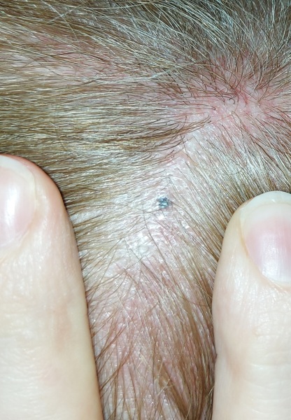 Daughter spotted this under my hair