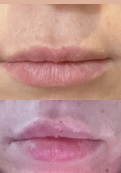 What could be done with my lips? Pics