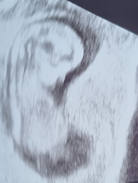 Due February 2025 - Thread 3