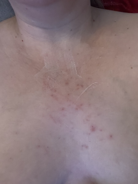 What’s this rash?