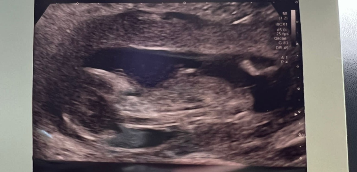 Gender guesses for fun?!