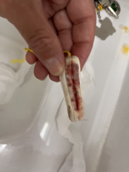 11dpo Nearly 10 years since first child