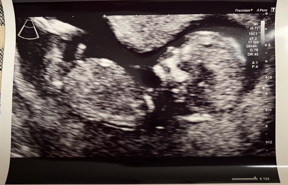 Can you see boy or girl in this?