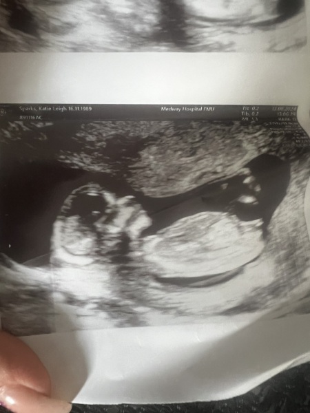 Boy or girl