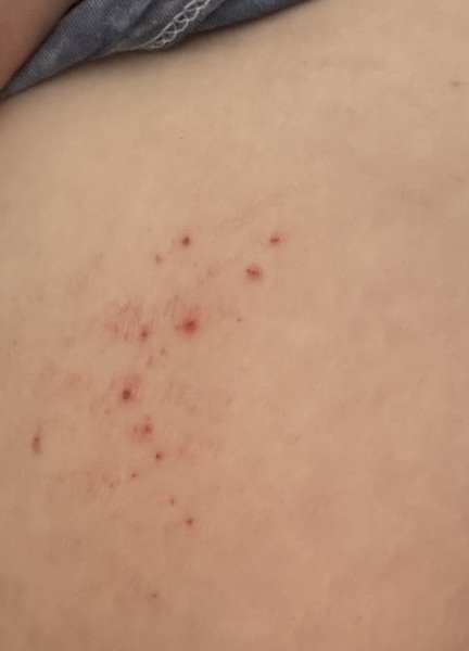 To ask what this rash is?