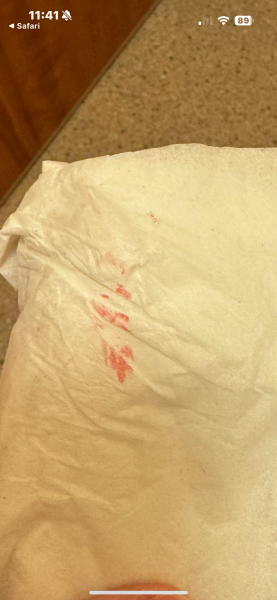 *TMI* [IMPLANTATION]