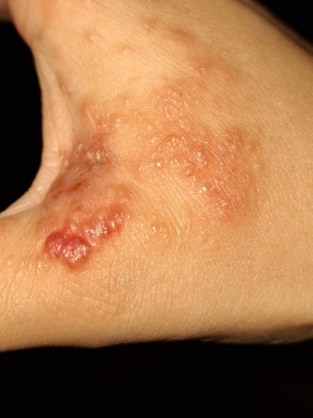 How long till antibiotics kick in?