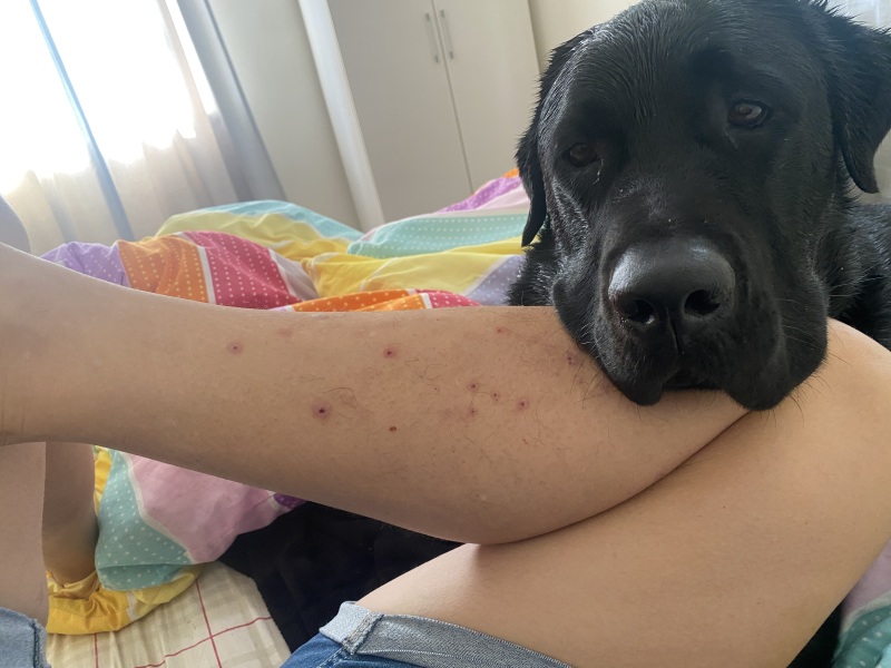 Attacked by Leeches- TMI Photos