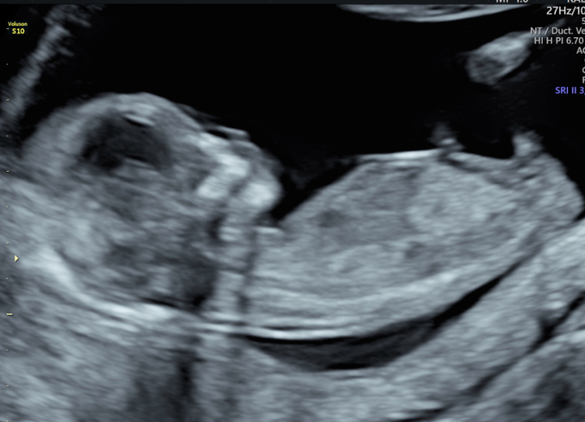 Boy or girl?