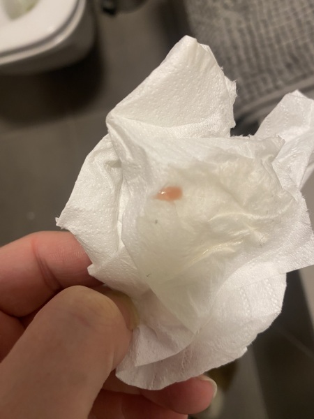 Implantation bleeding? ALERT PICTURE