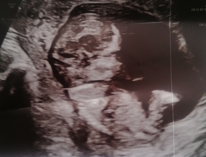 Due February 2025 - Thread 2