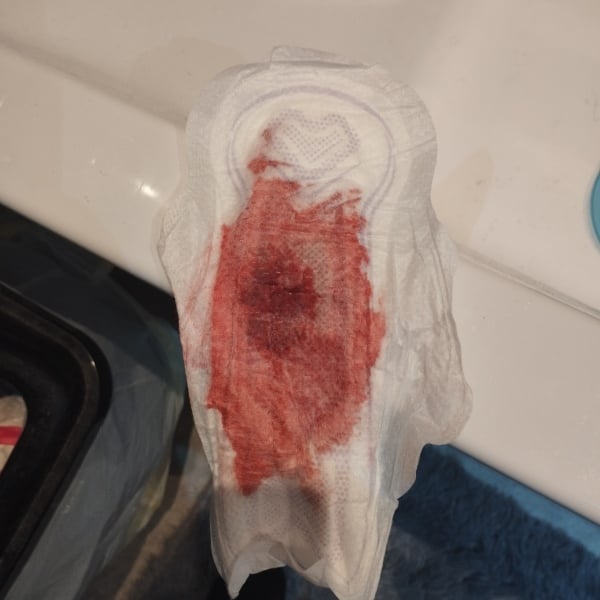 **Warning - graphic image ** Could this be implantation bleeding?