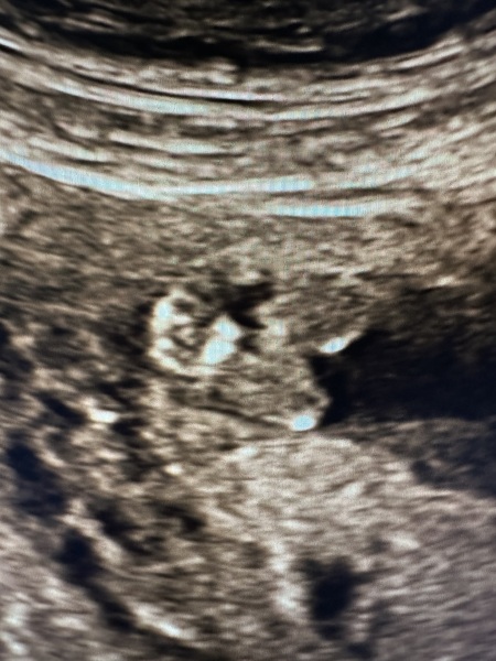 Help with potty shot 14 weeks